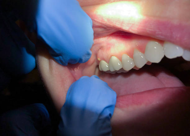 Best Emergency Treatment for Jaw Pain or Injury in Seguin, TX